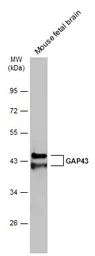 Anti-GAP43 antibody used in Western Blot (WB). GTX127937
